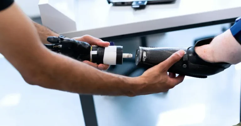 Profissional montando uma prótese no braço de uma pessoa como acontece no programa de reabilitação profissional do INSS