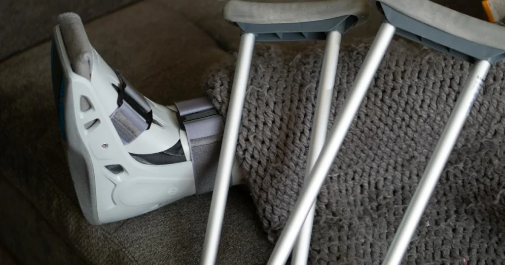 Pessoa com a perna imobilizada usada como referência ao assunto auxílio-doença